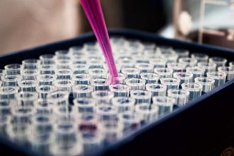 Reagenzgl&auml;ser mit Pipette